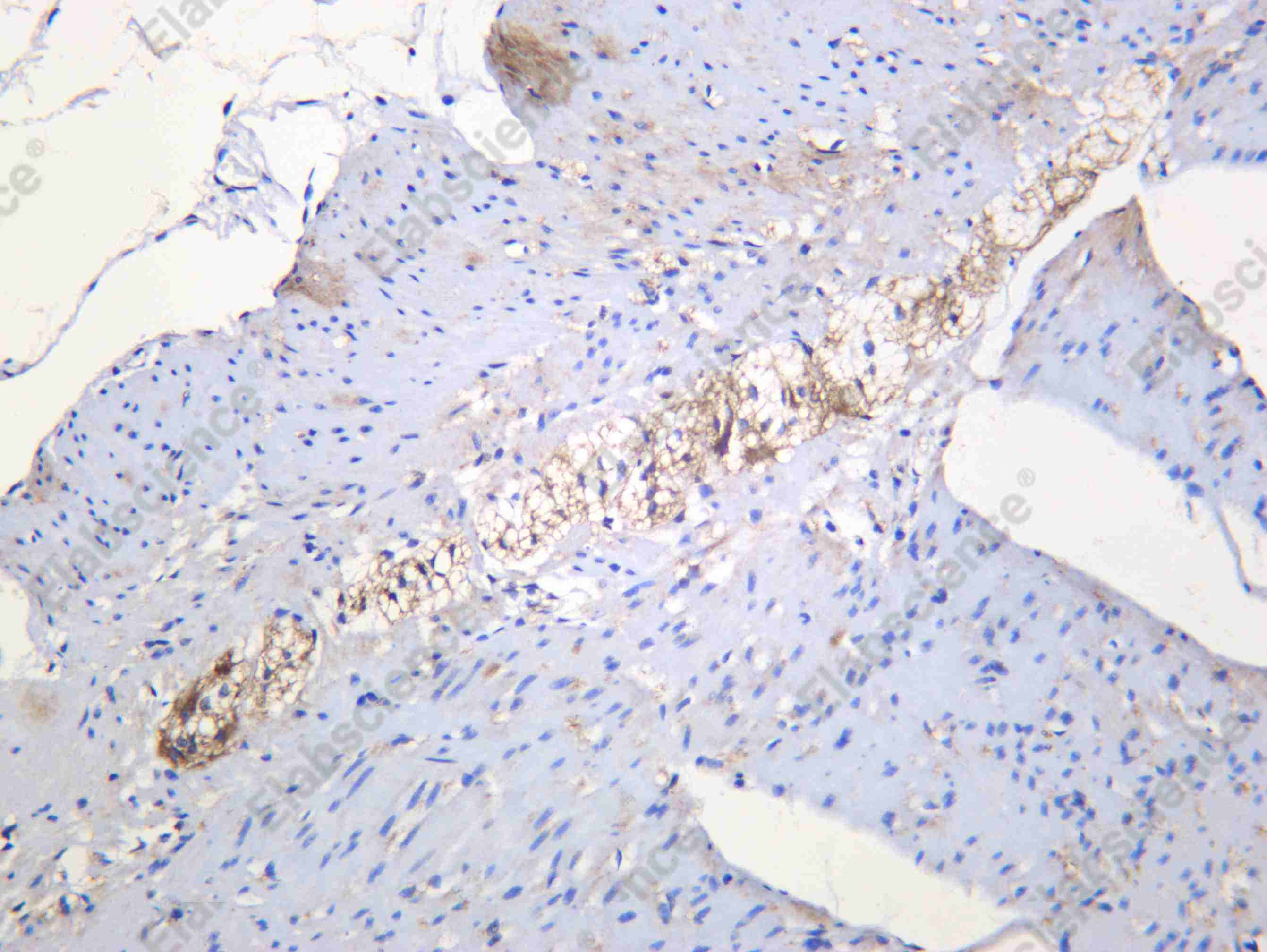 Recombinant PFKM Monoclonal Antibody - 1