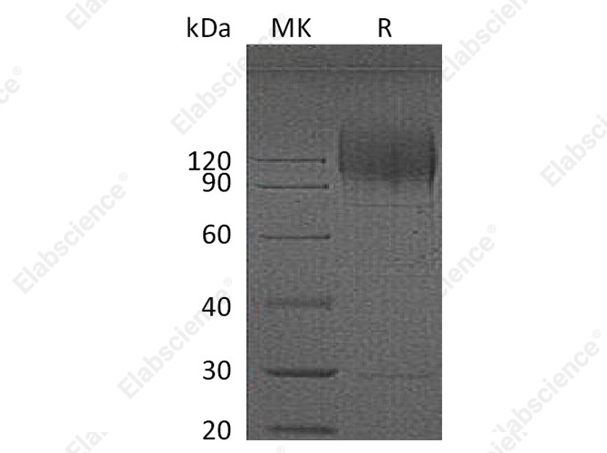 Recombinant HIV gp120 Protein (His Tag) - 1