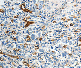 ABCG1 Polyclonal Antibody - 2