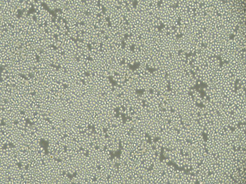 P3/NSI/1-Ag4-1 [NS-1] Cell Complete Medium-searchlist-1