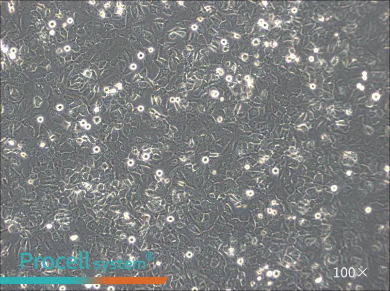 BPH-1 Cell Complete Medium - 1