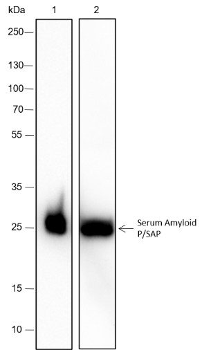 Recombinant Serum Amyloid P/SAP Monoclonal Antibody-searchlist-1