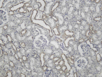 Recombinant Cathepsin B Monoclonal Antibody - 3