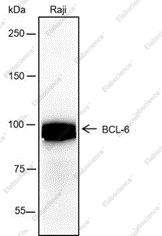 Recombinant BCL6 Monoclonal Antibody - 1