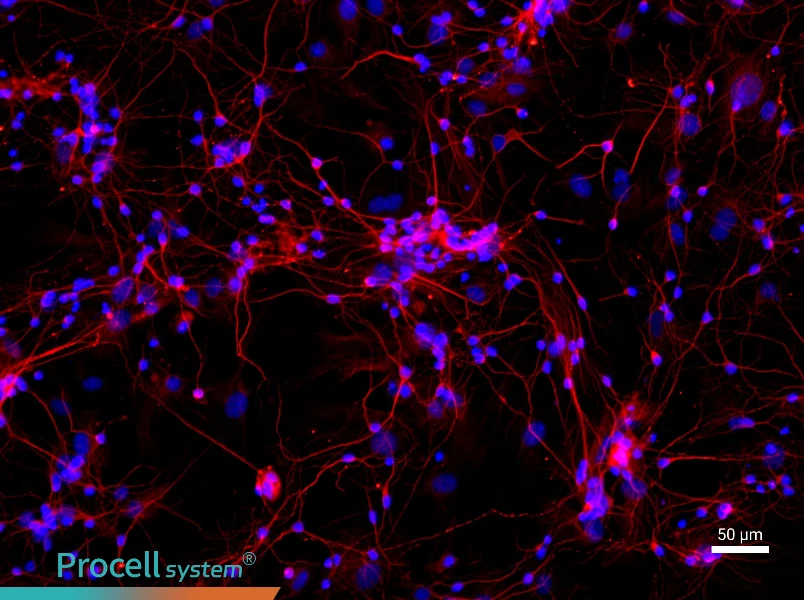 Rat Cortical Neurons - 1