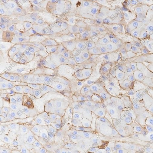 Recombinant CD138/Syndecan-1 Monoclonal Antibody - 3