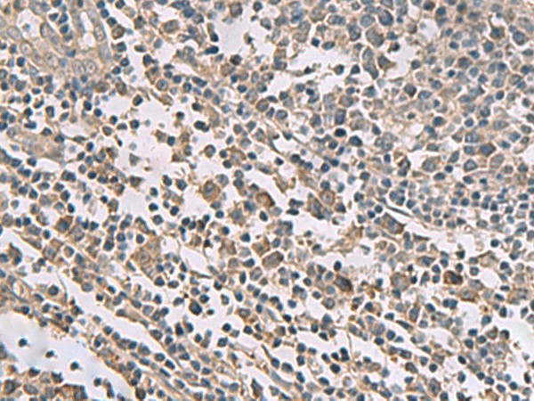 Immunohistochemistry of paraffin-embedded Human tonsil tissue  using TMEM141 Polyclonal Antibody at dilution of 1:60(?200)