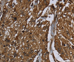 ARHGDIA Polyclonal Antibody - 3