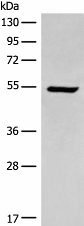 Western blot analysis of HEPG2 cell lysate  using ACD Polyclonal Antibody at dilution of 1:400