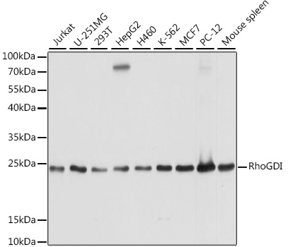 Western blot analysis of extracts of various cell lines using RhoGDI Polyclonal Antibody at 1:1000 dilution.