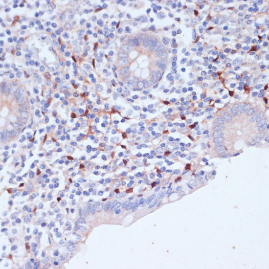 Immunohistochemistry of paraffin-embedded human appendix using WIPF1 Polyclonal Antibody at dilution of 1:100 (40x lens).Perform microwave antigen retrieval with 10 mM PBS buffer pH 7.2 before commencing with IHC staining protocol.