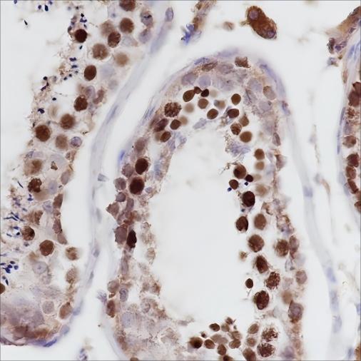 Recombinant PTBP2 Monoclonal Antibody - 2