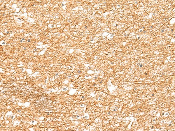 Immunohistochemistry of paraffin-embedded Human brain tissue  using ZNF185 Polyclonal Antibody at dilution of 1:25(?200)