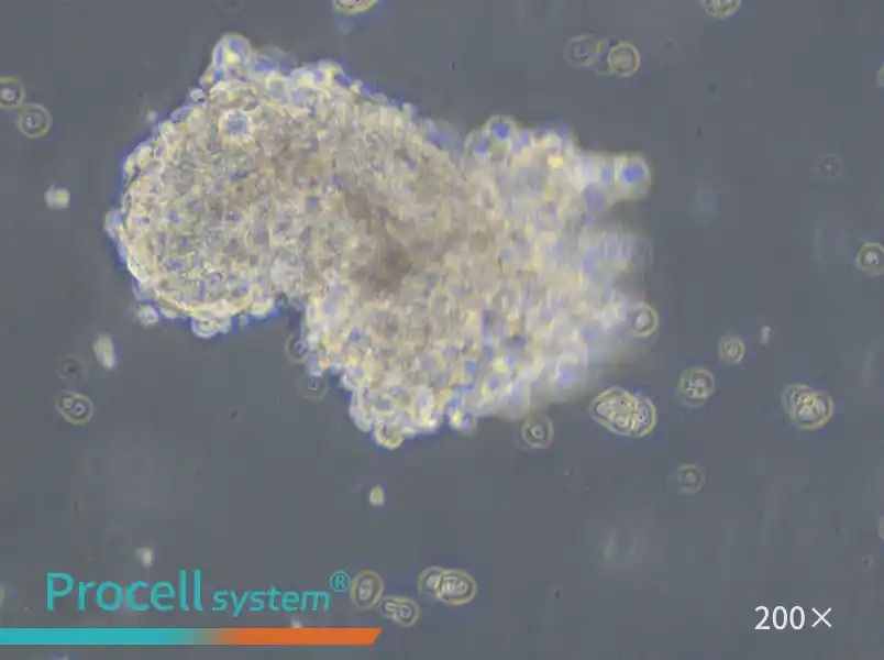 AtT-20 Cell Complete Medium - small - 5