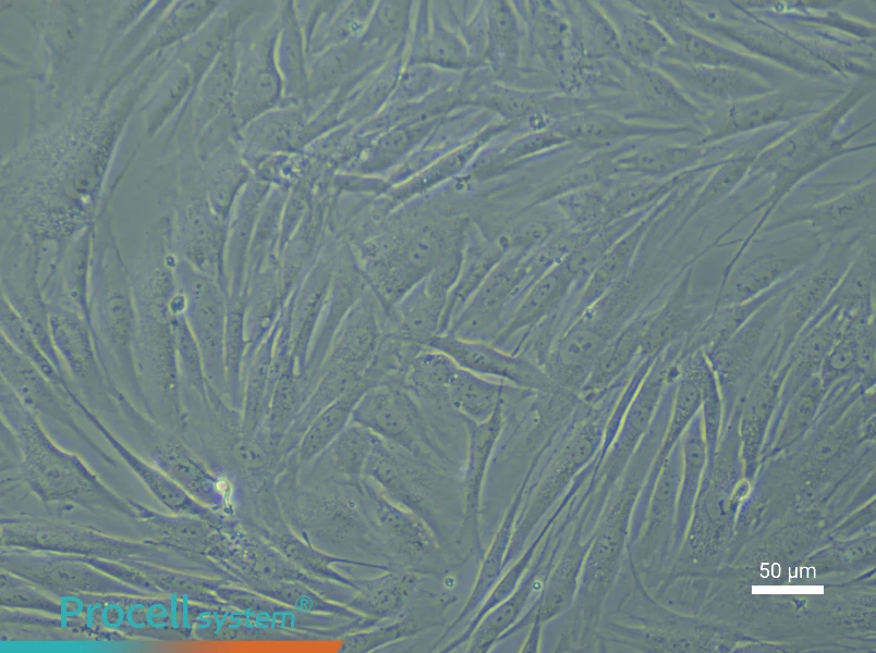 Human Esophageal Smooth Muscle Cell Complete Medium - 4