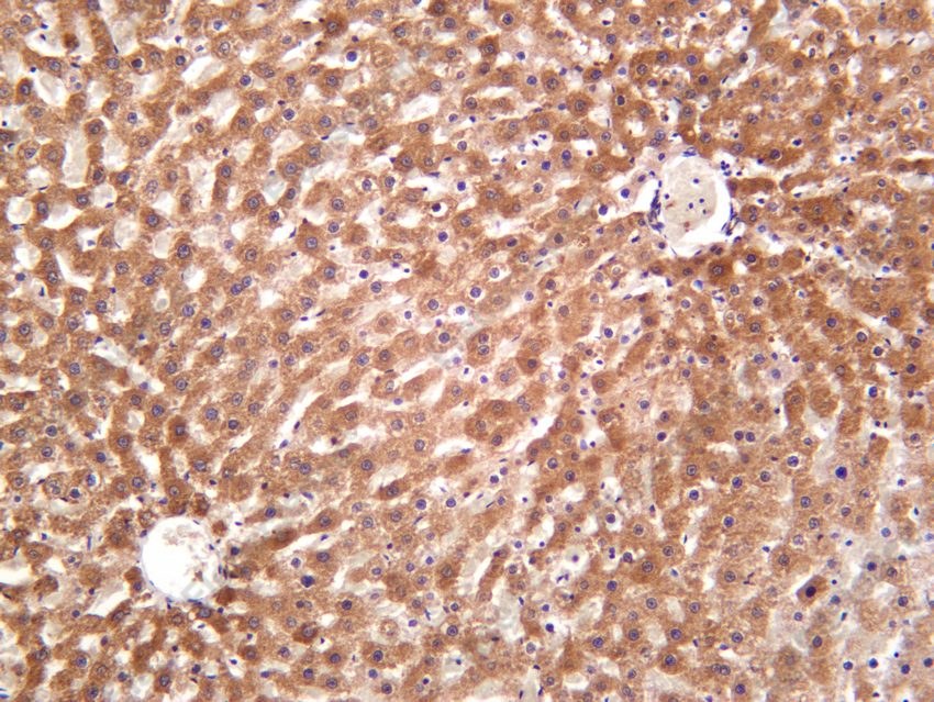 Recombinant IFNGR1/CD119/IFN-gamma-R1 Monoclonal Antibody - 3