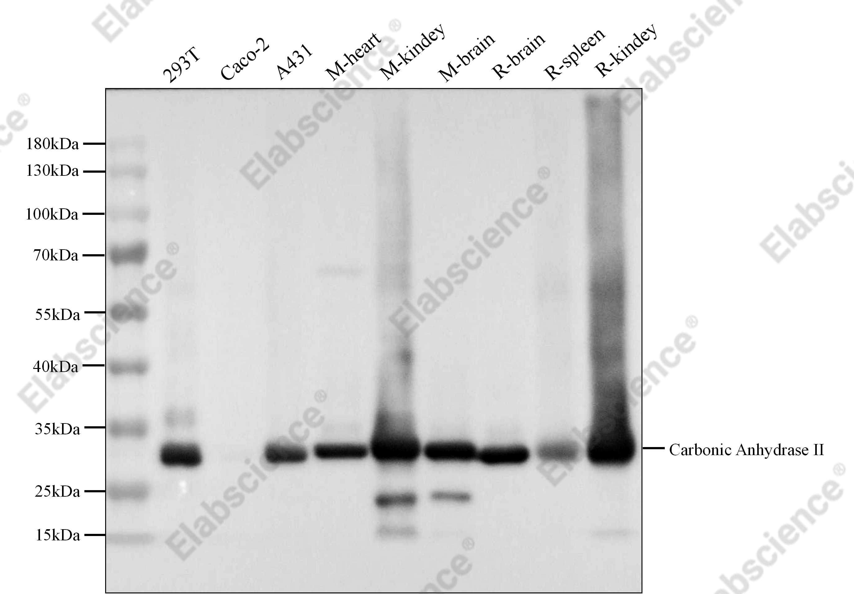 Recombinant Carbonic Anhydrase II/CA2 Monoclonal Antibody - 4