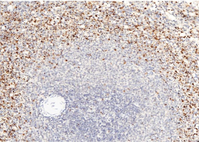 Recombinant Granzyme B/GZMB Monoclonal Antibody - small - 2