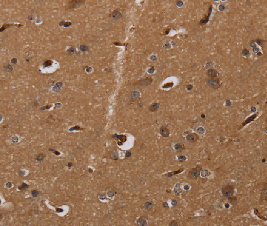 MOB1A Polyclonal Antibody - 3