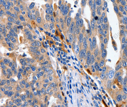 IL18 Polyclonal Antibody - 2