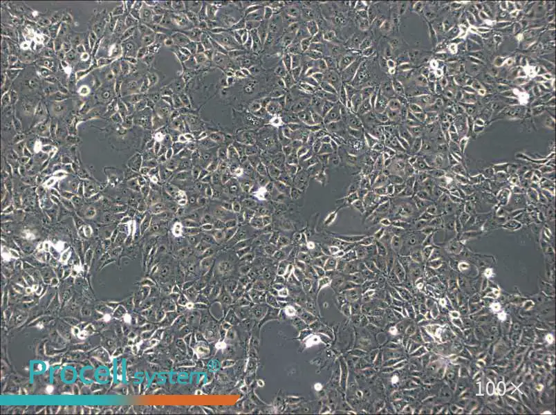 ST Cell Complete Medium - 1