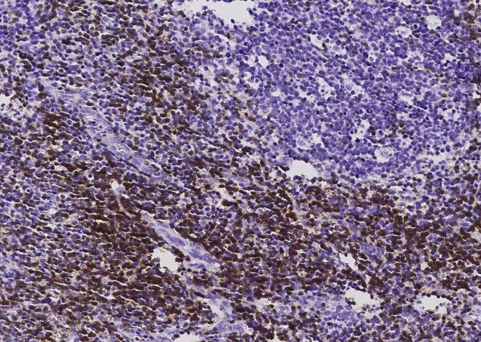 Recombinant CD3D & CD3E Monoclonal Antibody-searchlist-1