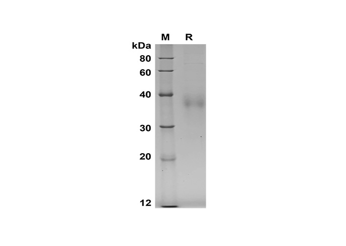 Recombinant Mouse Il17F Protein(Sumo Tag)-产品推荐-1