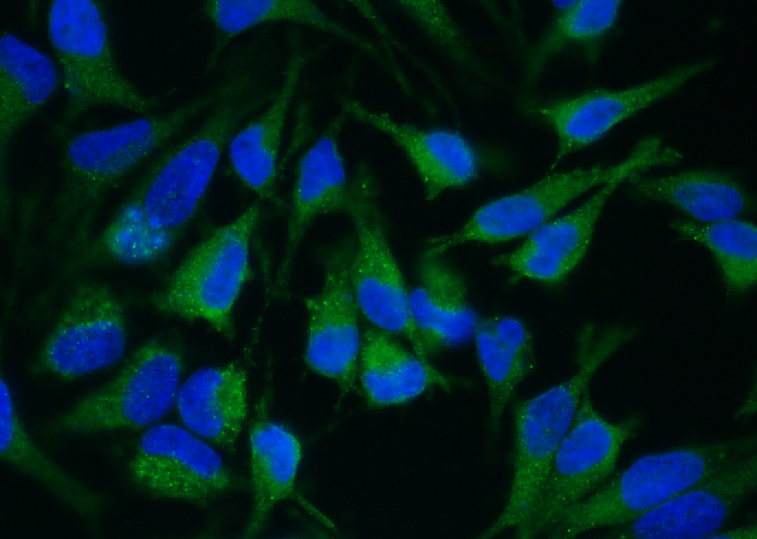 Recombinant ADAM15/MDC15 Monoclonal Antibody - small - 2