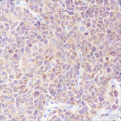 Recombinant Smac/Diablo Monoclonal Antibody - 2