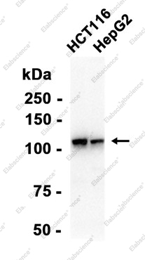 Recombinant MVP Monoclonal Antibody - 2