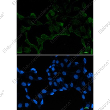 Recombinant SF2 Monoclonal Antibody - 4