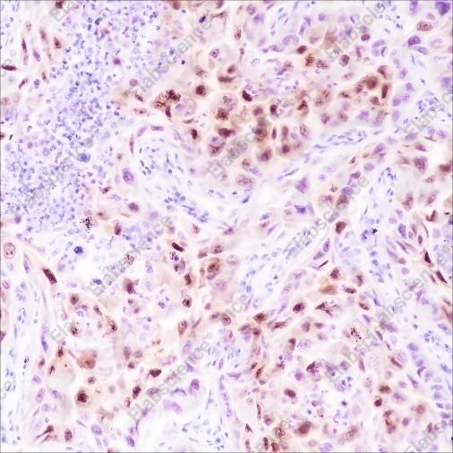 Recombinant CDKN2A/p14ARF Monoclonal Antibody - 2