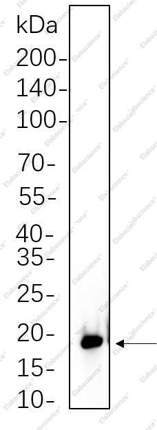 Recombinant Phospho-4E-BP1 (Thr37/46)) Monoclonal Antibody - 1