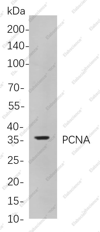 Recombinant PCNA Monoclonal Antibody - 1