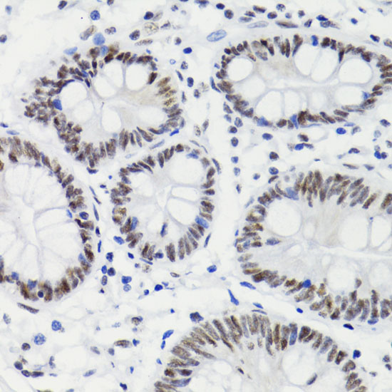 Immunohistochemistry of paraffin-embedded Human stomach using Bcl-2 Polyclonal Antibody at dilution of 1:200 (40x lens).