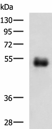 Western blot analysis of Human colorectal cancer tissue lysate  using METTL17 Polyclonal Antibody at dilution of 1:700