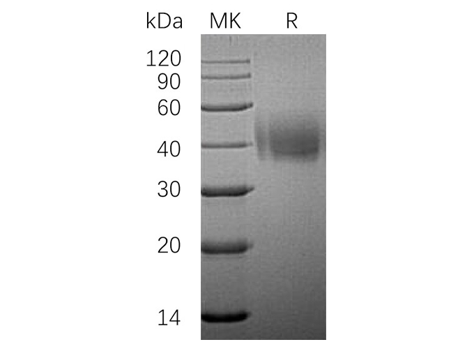 Recombinant Human SLAMF7/CD319 Protein (His Tag)