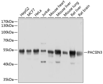 Western blot analysis of extracts of various cell lines using PACSIN3 Polyclonal Antibody at dilution of 1:1000.