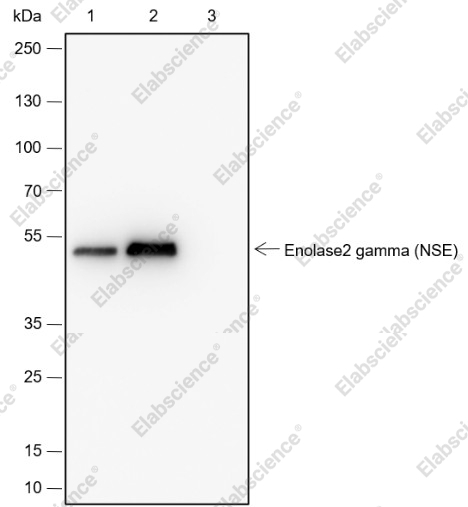 Recombinant NSE Monoclonal Antibody - 7