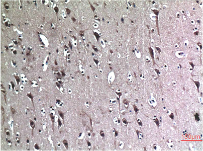 Immunohistochemistry of paraffin-embedded Human brain tissue using BECN1 Monoclonal Antibody at dilution of 1:200.