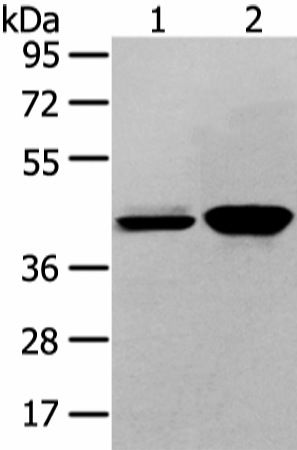 Western Blot analysis of Hela and 293T cell using VASH2 Polyclonal Antibody at dilution of 1/450