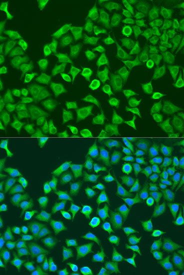 Immunofluorescence analysis of U2OS cells using Pumilio 1 Polyclonal Antibody at dilution of 1:100. Blue: DAPI for nuclear staining.
