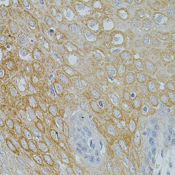 Immunohistochemistry of paraffin-embedded Human esophagus using NTF3 Polyclonal Antibody at dilution of  1:100 (40x lens).