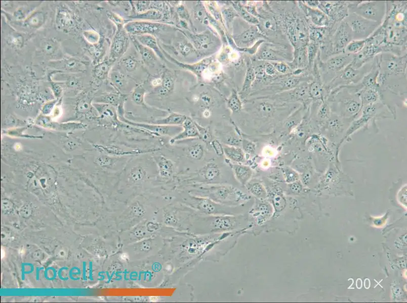 NCI-H2347 Cell Complete Medium - 6