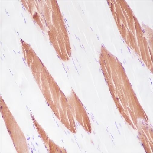 Recombinant Myosin Light Chain 3 Monoclonal Antibody - small - 2