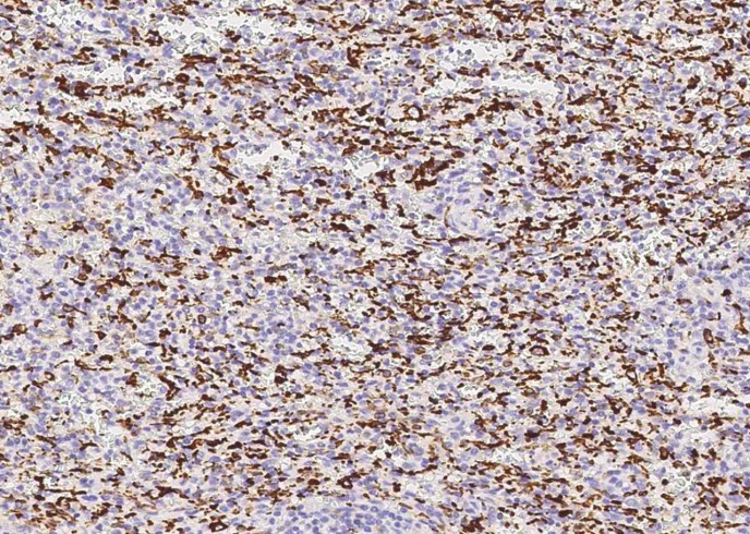 Recombinant IBA1/AIF1 Monoclonal Antibody-searchlist-1