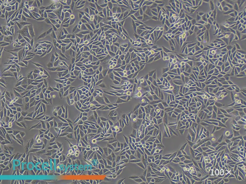 SiHa Cell Complete Medium - 3