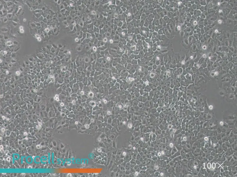 SACC-83 Cell Complete Medium - 1