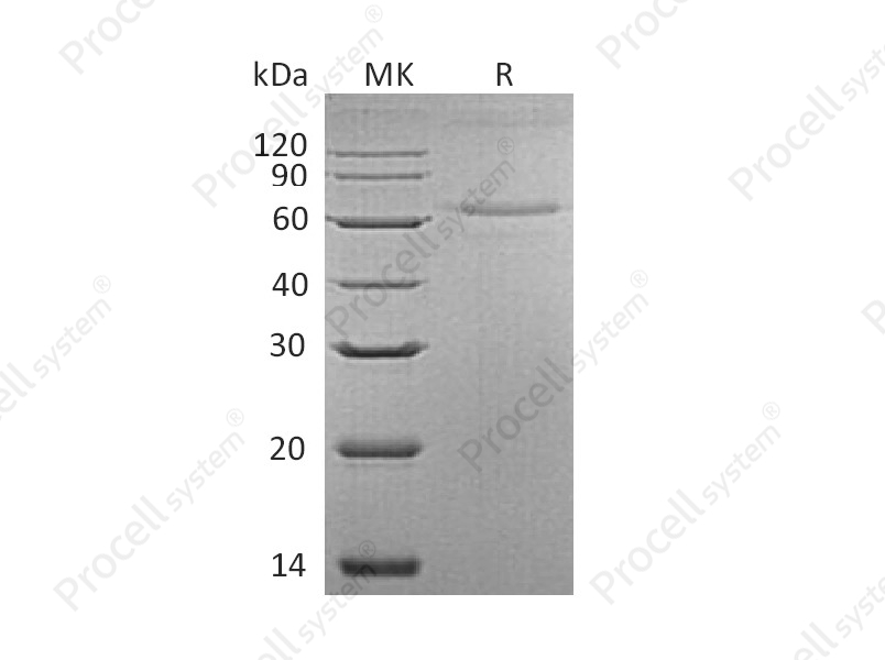 IL-27 (C-6His), Mouse, Recombinant