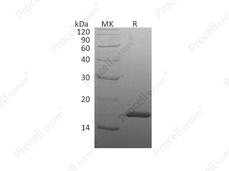 IL-1&beta;/IL1F2, Human, Recombinant